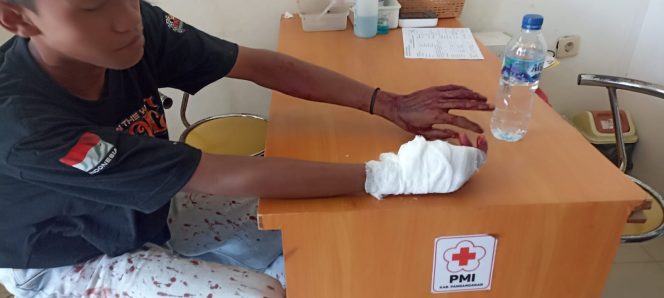 
					Pemotor RX KING Asal Cilacap Nyaris Jadi Korban Pembacokan di Pangandaran, Sempat Ditangkis Saat Diserang